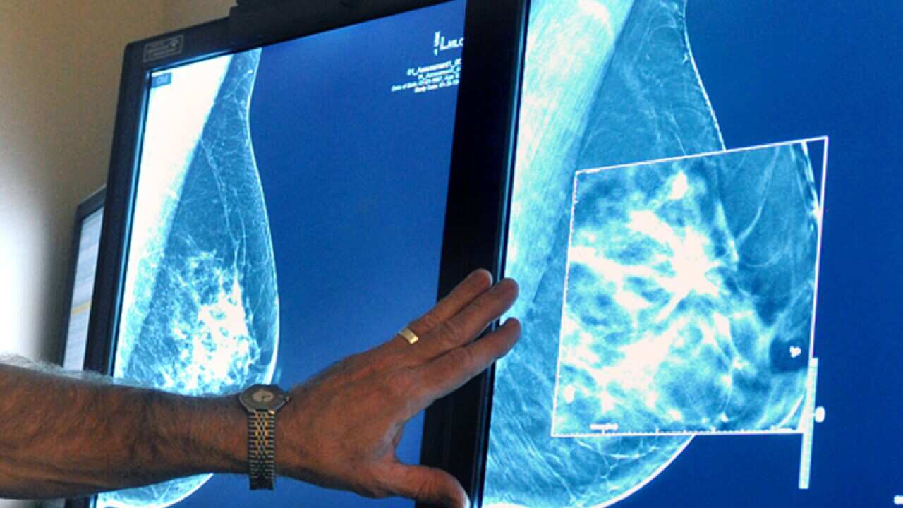 A radiologist compares an image from earlier, 2-D technology mammogram