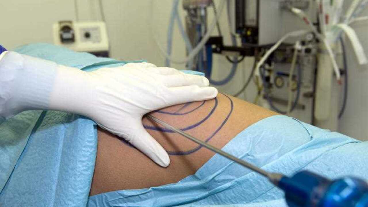 The Medical Board of Australia has released new guidelines for the cosmetic surgery industry.