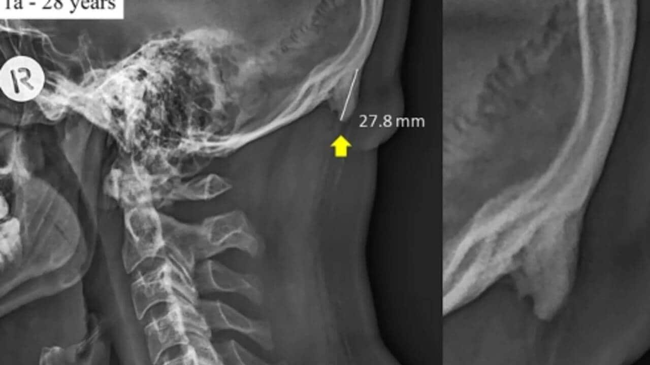 Image for read more article ''