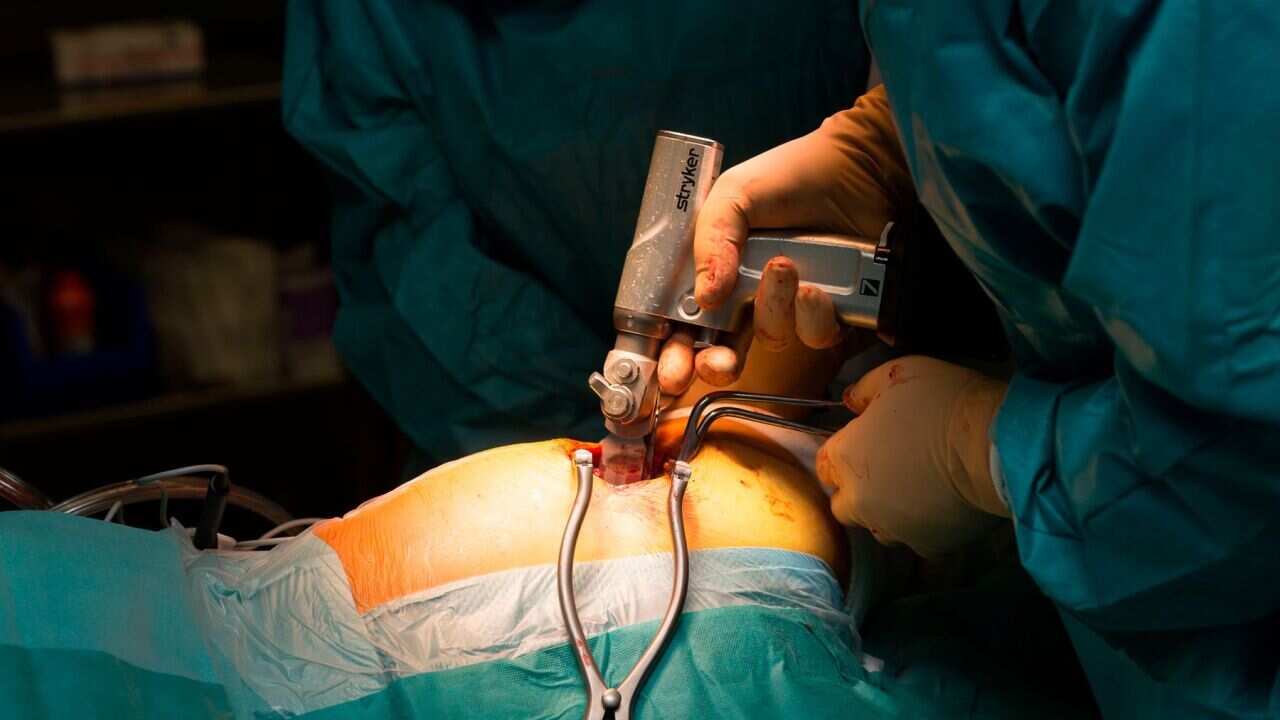 Hip replacement surgery, Saint George Clinic, Nice, France Fitting dual mobility hip prosthesis in patient suffering from osteonecrosis Cutting the bone. (Photo by: BSIP/Universal Images Group via Getty Images)