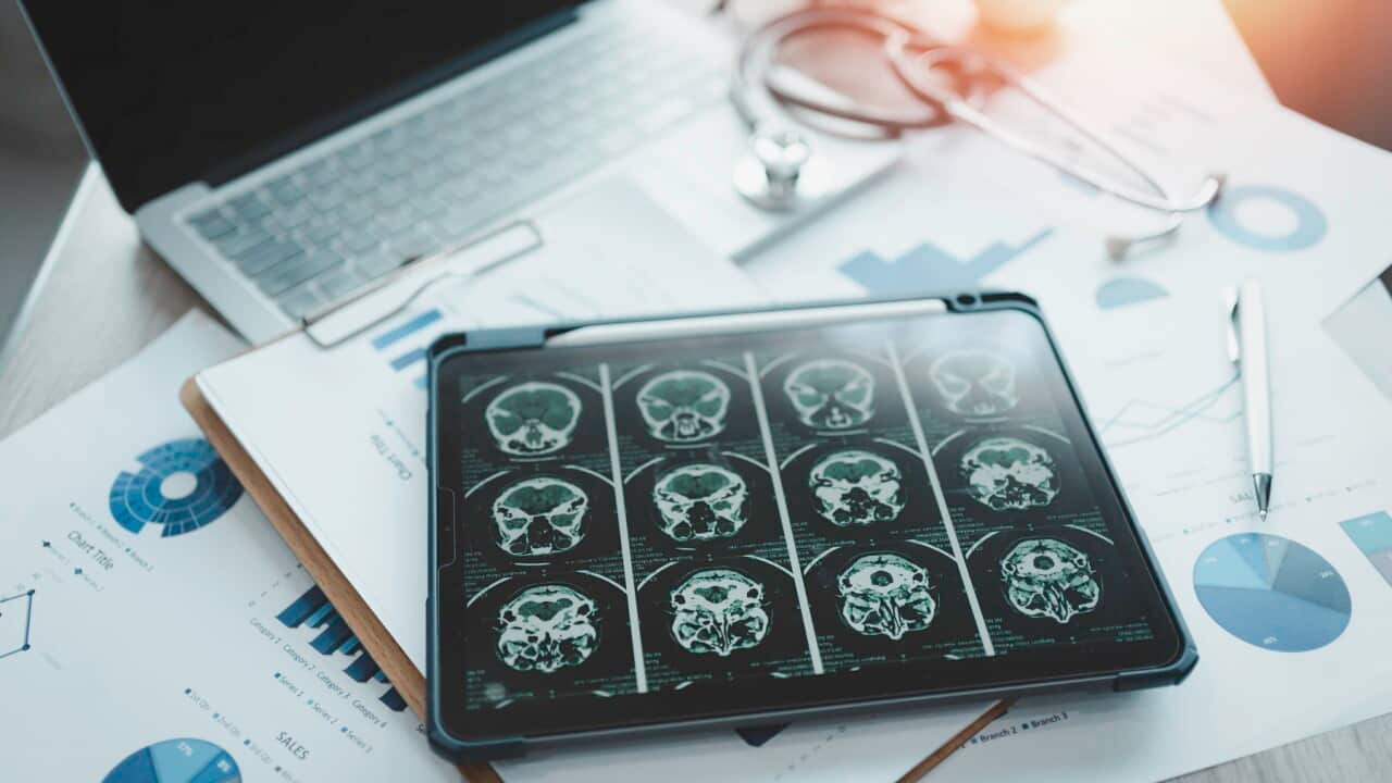 Close-up of a digital tablet with brain x-ray on screen.