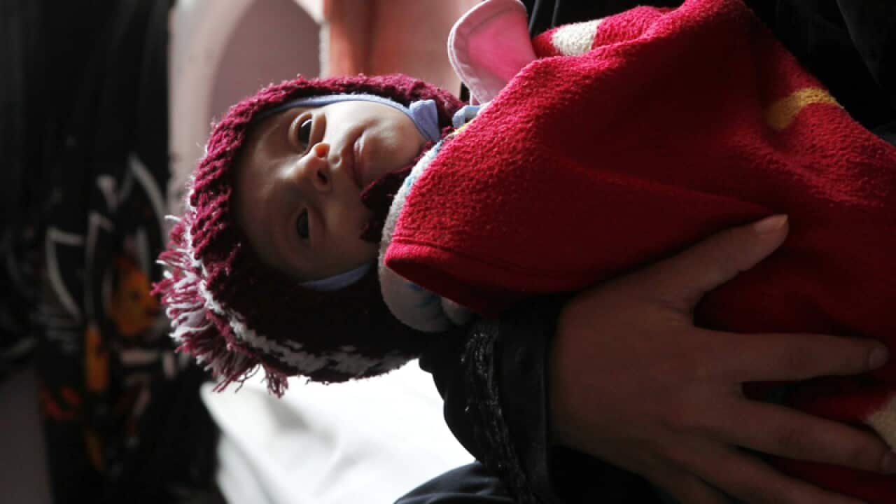 A Yemeni woman holds her child suffering from malnutrition