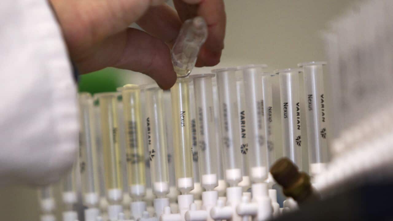 A laboratory technician prepares samples of urine for testing