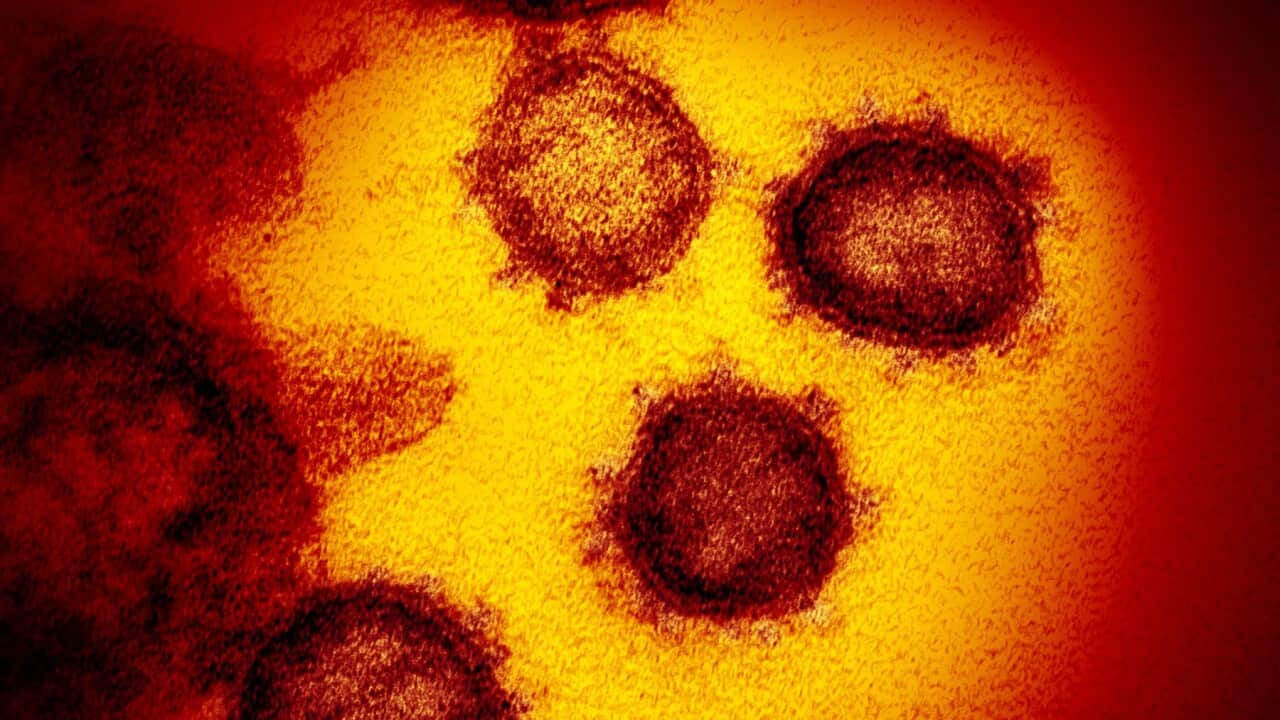 An electron microscope image of the Novel Coronavirus SARS-CoV-2, the virus that causes COVID-19