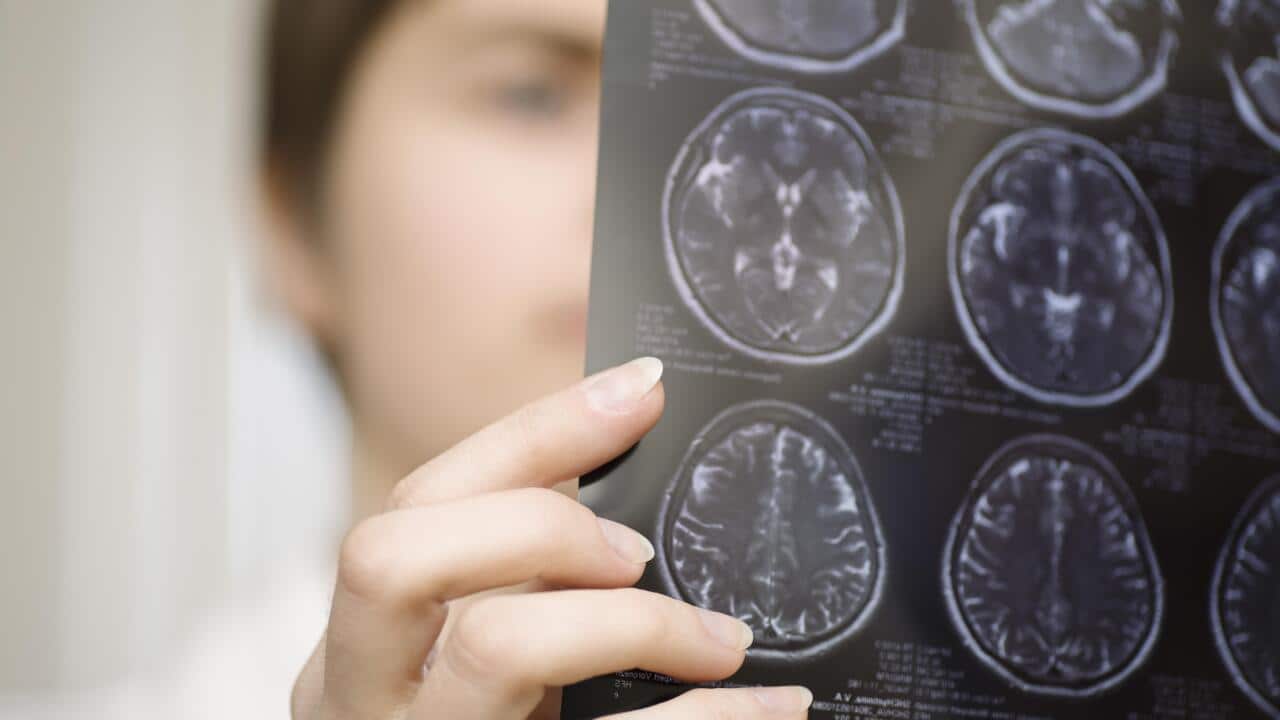 Fresh hope after multiple sclerosis breakthrough