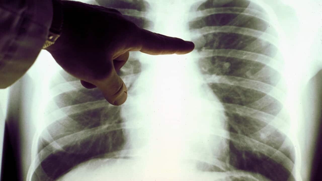 Cancer Images
