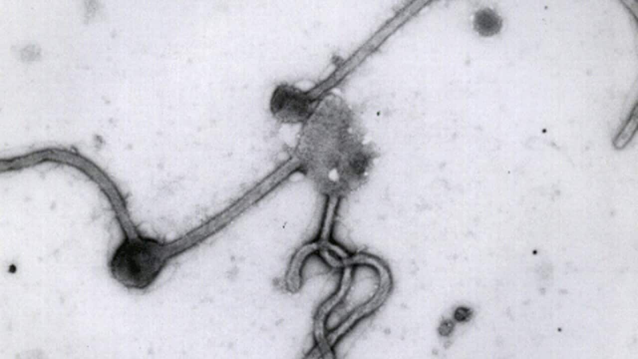 A view of the Ebola Virus.