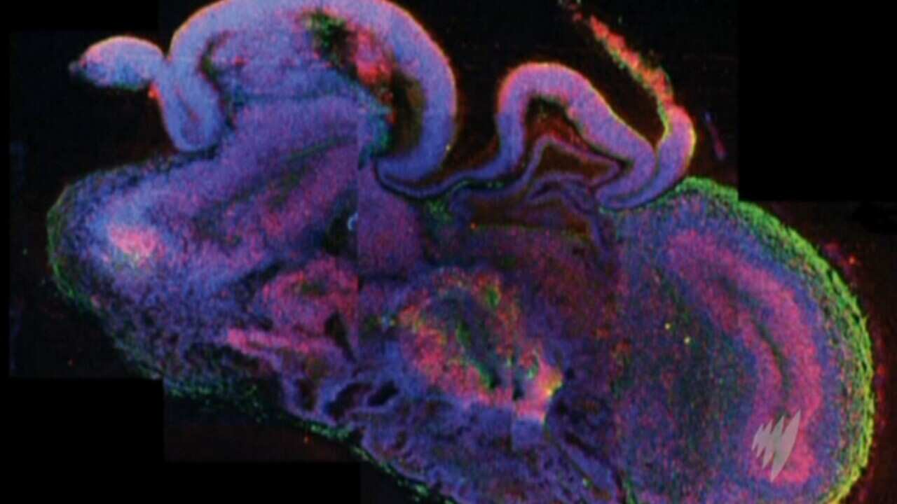 290813_Brain_Cells_BBC copy.jpg