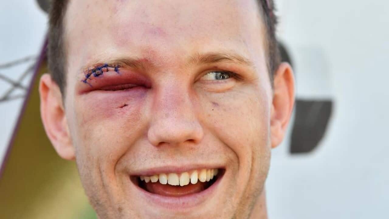 WBO World Welterweight Champion Jeff Horn