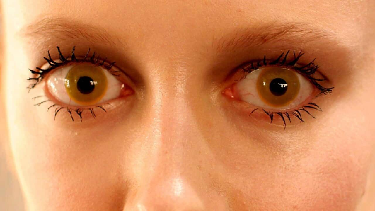 Women wearing yellow contact lenses