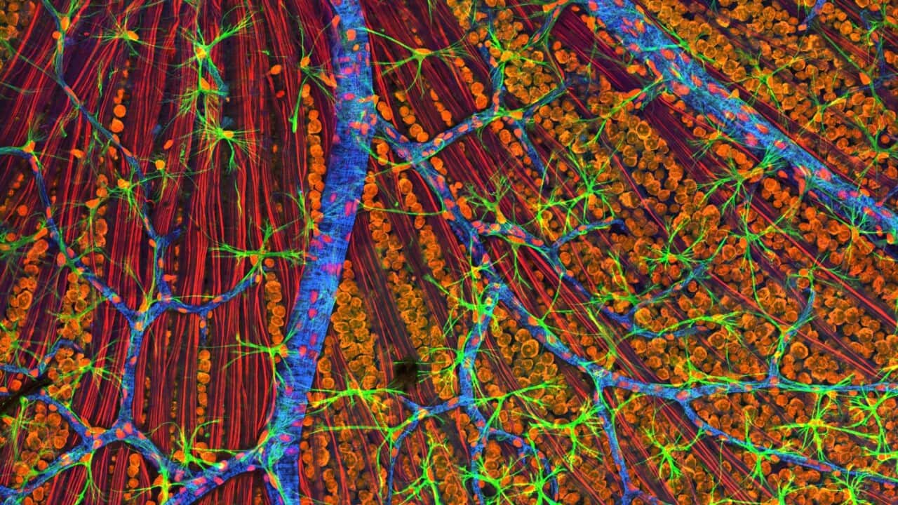 Image for read more article 'READ MORE'