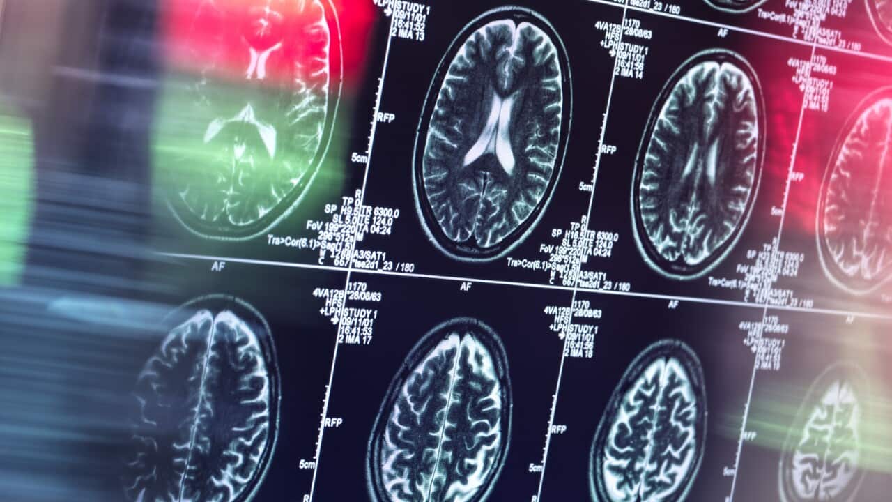 Human brain scan in neurology clinic
