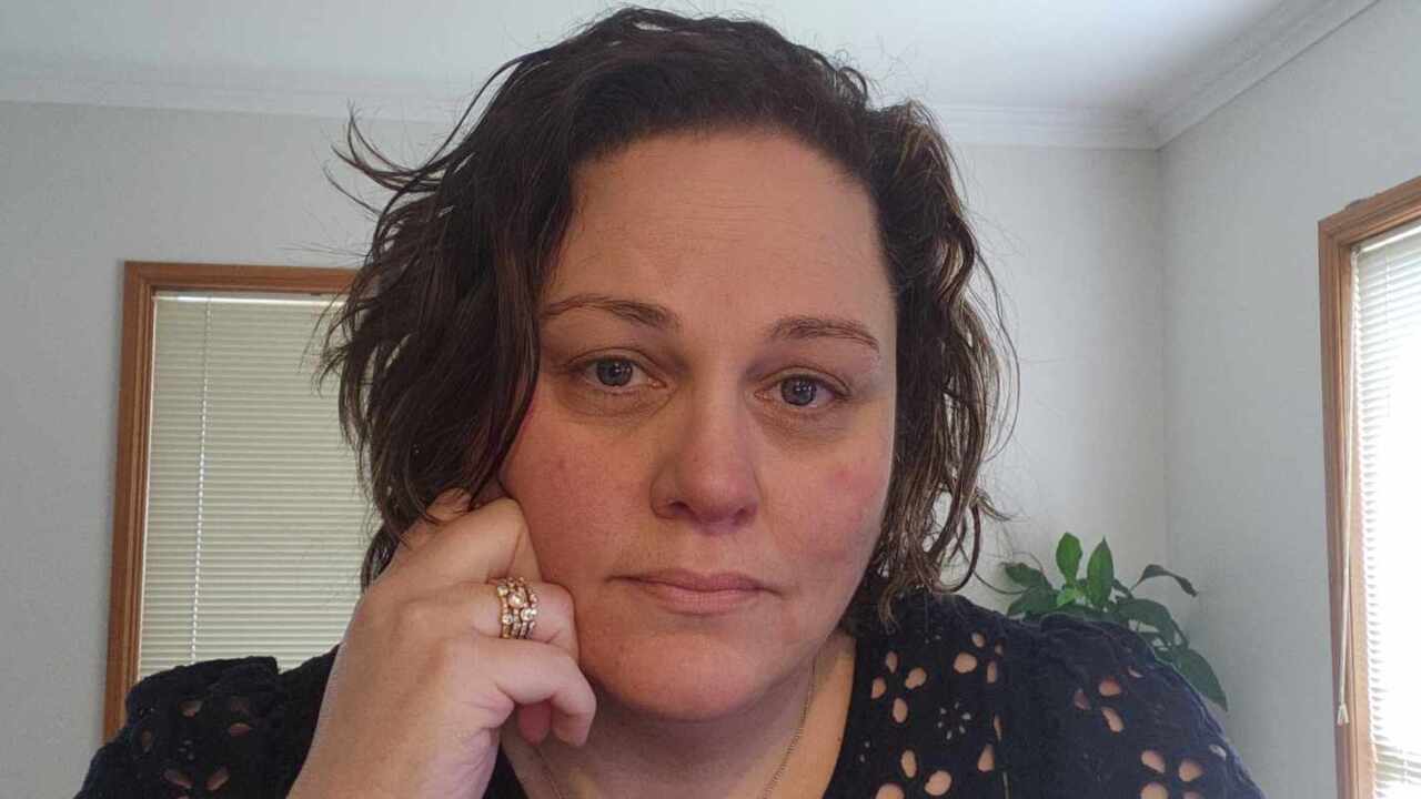 A woman with short brown hair with her hand held up to her cheek