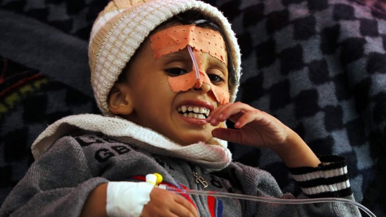 A malnourished Yemeni child receives treatment amid worsening malnutrition at a hospital in Sana'a, Yemen