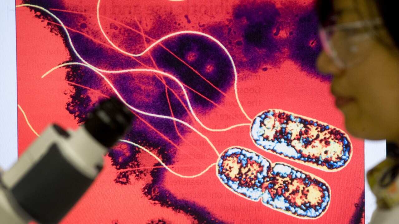Infectious disease researchers study Superbugs in a laboratory at the University of Queensland Centre for Clinical Research. (File: AAP)