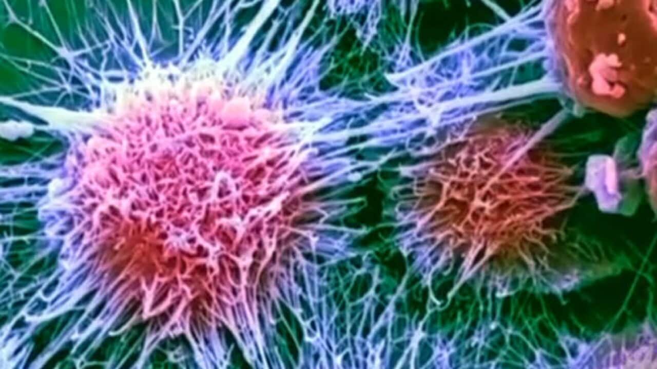 CANCER_CELLS_918521735