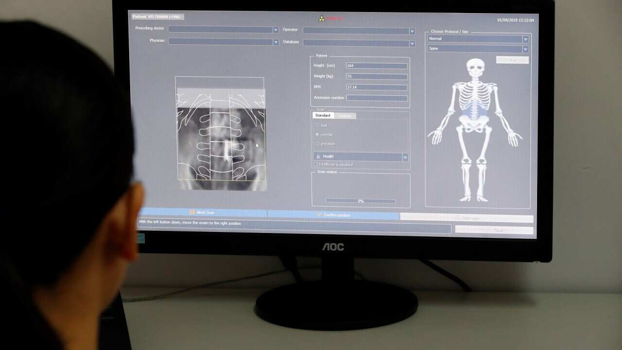 Medix 90 a tool for routine osteoporosis and fracture risk assessment. Cardiology hospital. Ho Chi Minh City. Vietnam.