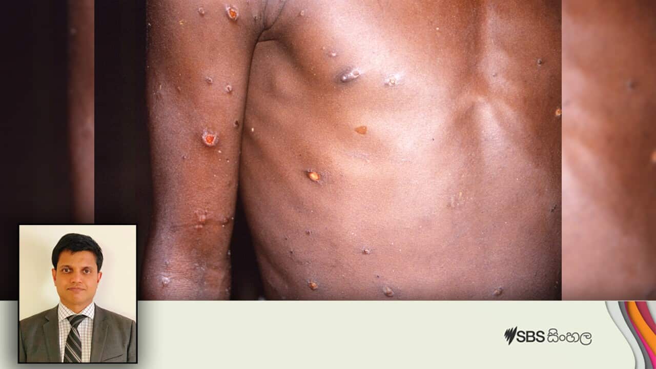 Interviews Dr Thushara.jpg