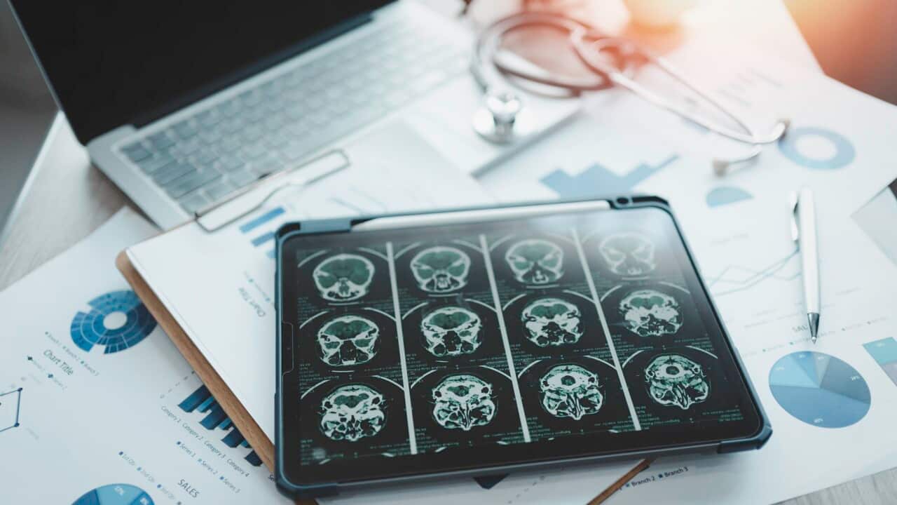 Close-up of a digital tablet with brain x-ray on screen.