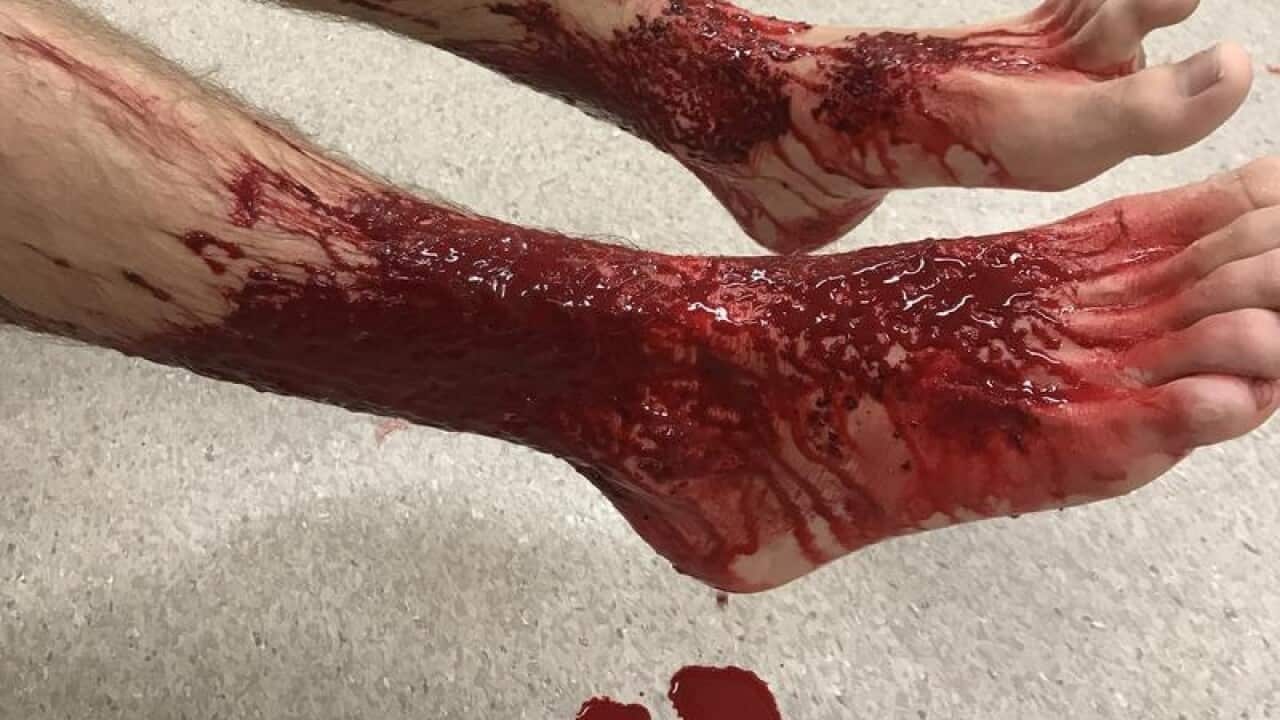 Image for read more article ''