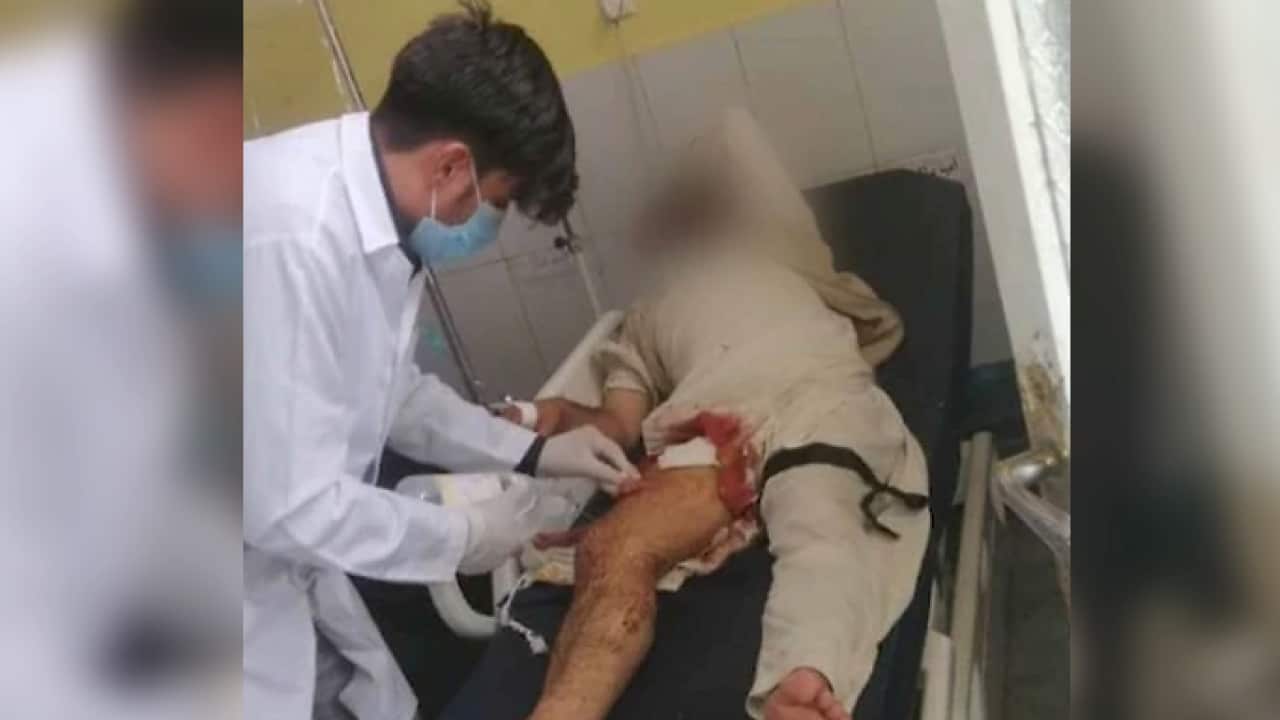 The Afghan interpreter who served with Australia in 2011 says he was shot at Kabul airport.