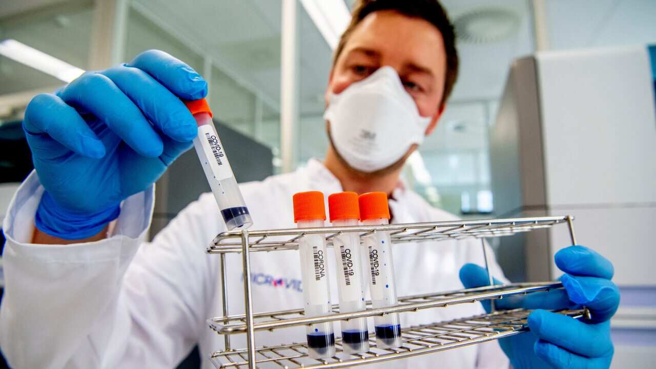 People working in the Microvida laboratory