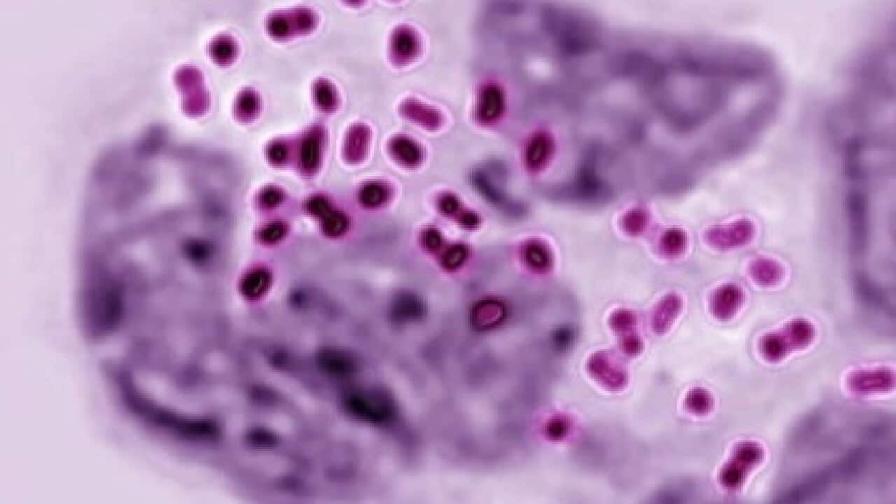 File photo: Neisseria Gonorrhea