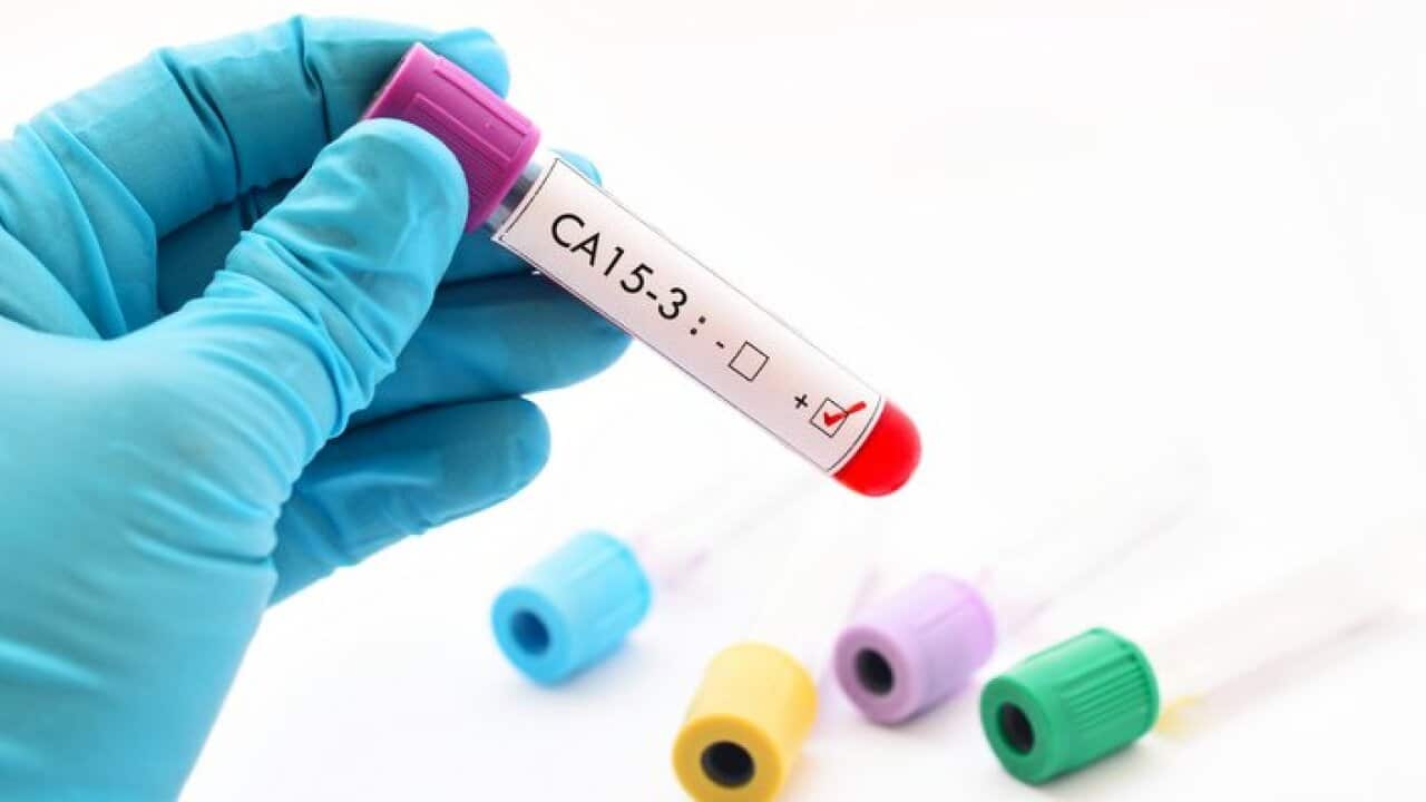 CA15-3 positive