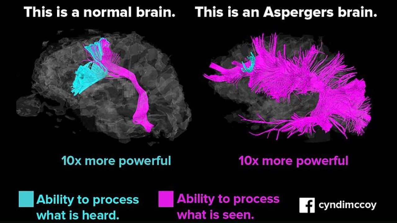 Asperger