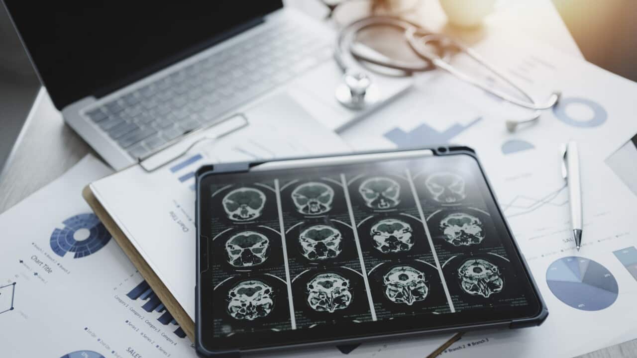Close-up of a digital tablet with brain x-ray on screen.