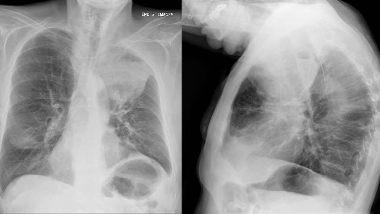 Image for read more article 'ΔΕΙΤΕ ΑΚΟΜΗ'