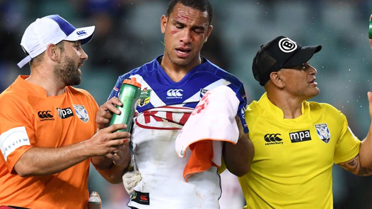 Will Hopoate (centre) of the Bulldogs