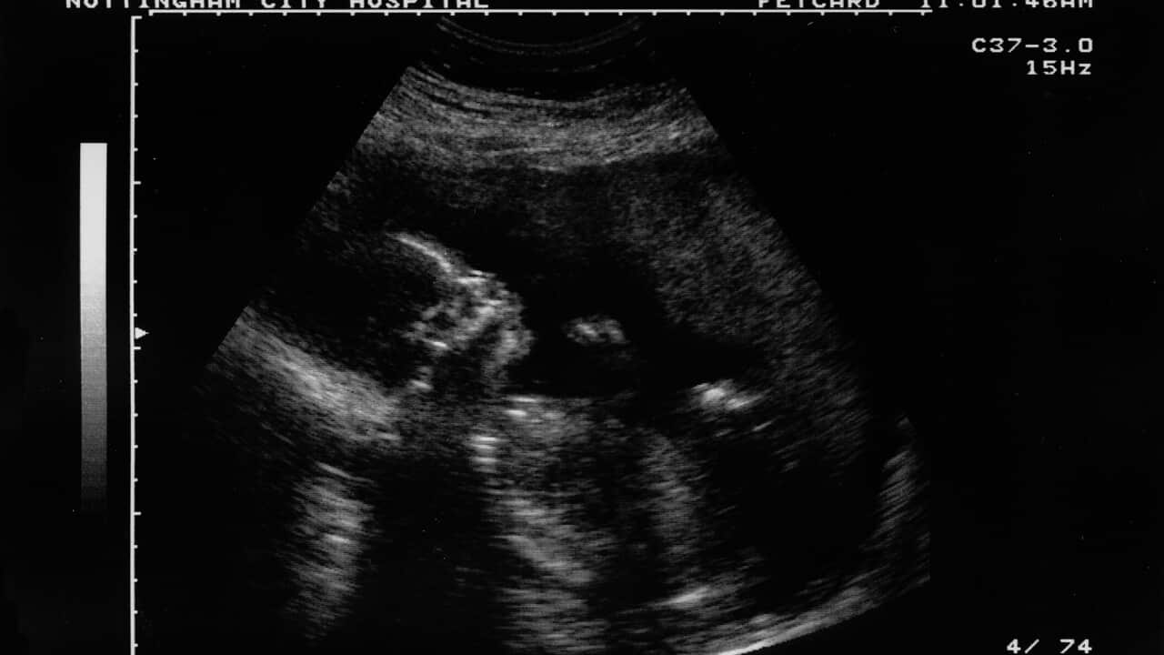 Ultrasound (illustration photo)
