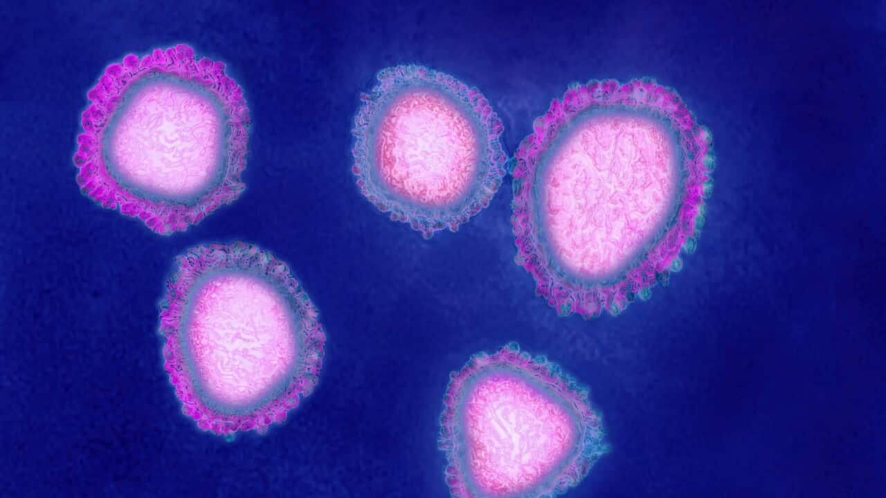 The human coronavirus causes respiratory infections (colds), and gastroenteritis. Image made from a transmission electron microscopy view. Approximate viral diameter: 80 to 160 nm. (Photo by: Cavallini James/BSIP/Universal Images Group via Getty Images)