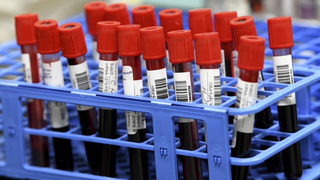 Blood samples from volunteers participating in a phase three vaccine trial at the University of Miami.