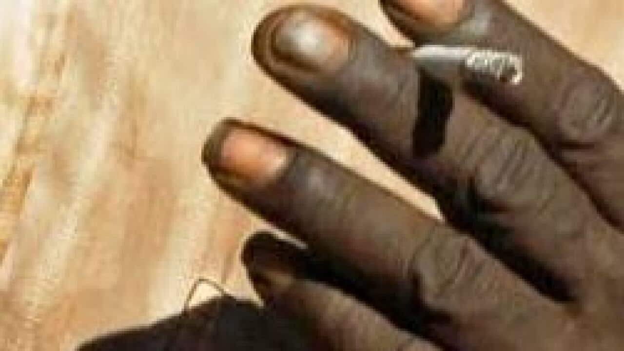 Indigenous smoking rates still a major concern