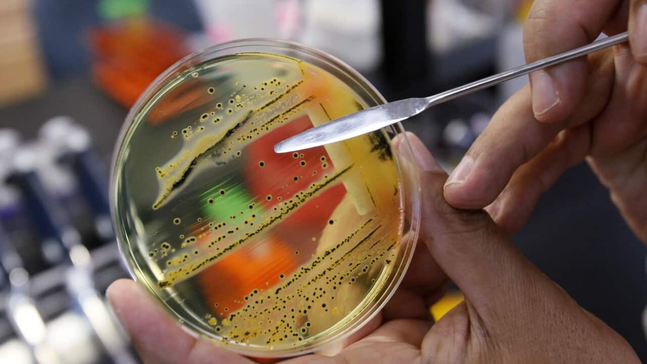 Salmonella growing in a petri dish