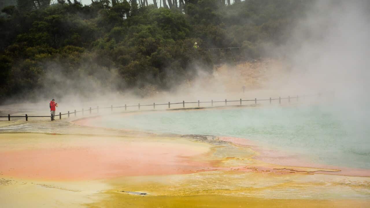 Rotorua Mountain Biking off the bike