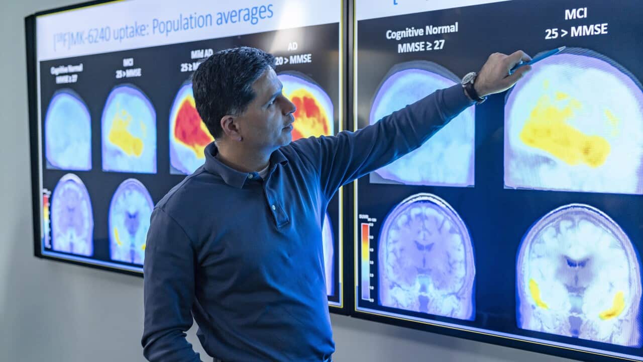 Biogen Inc doctor looks at scans. The US Food and Drug Administration issued accelerated approval for the experimental drug Aduhelm.