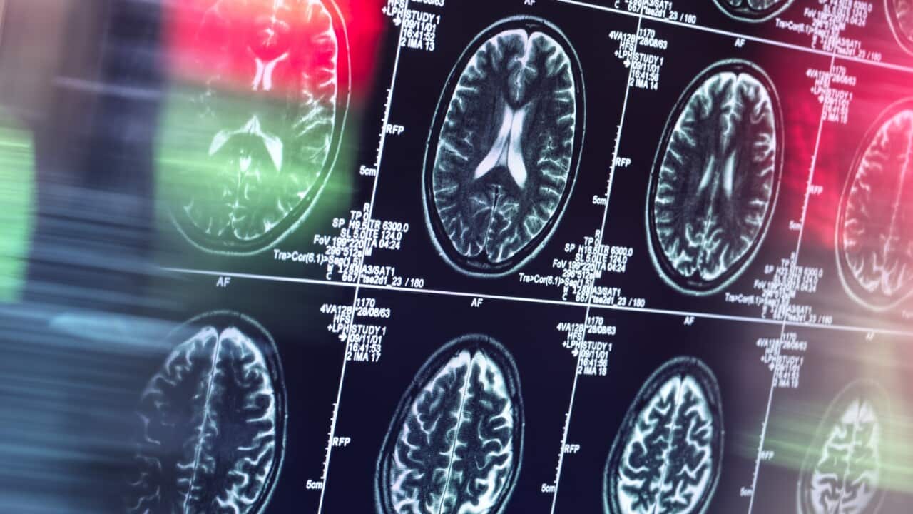 Human brain scan in neurology clinic