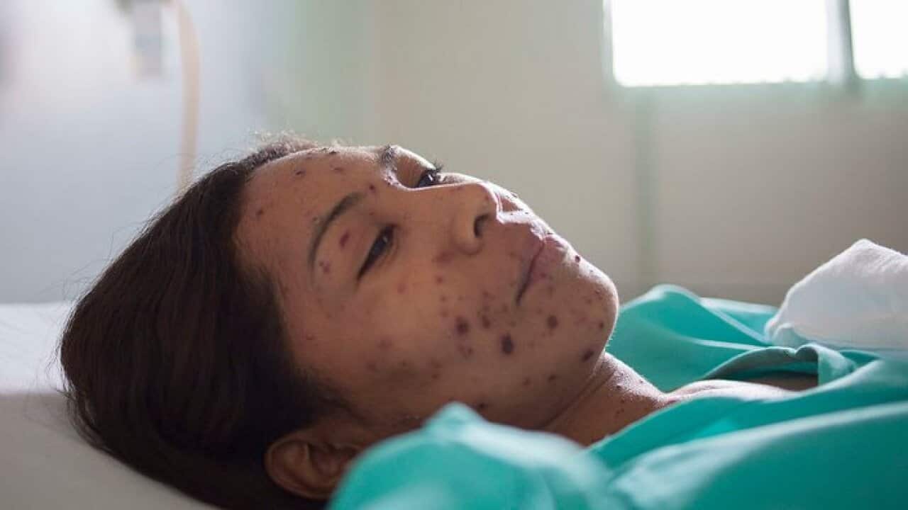 Image for read more article ''