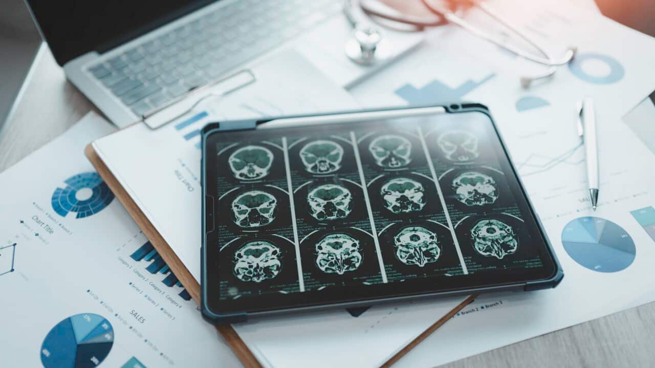 Close-up of a digital tablet with brain x-ray on screen.