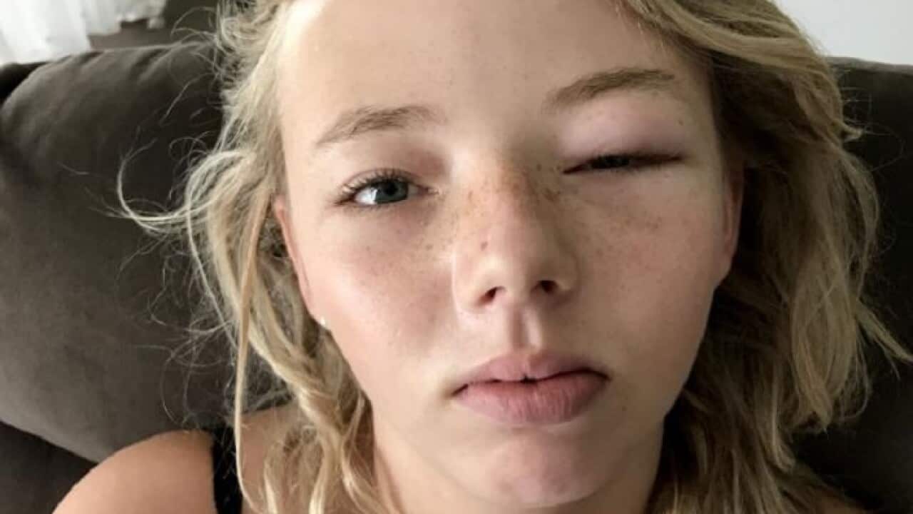 Image for read more article ''