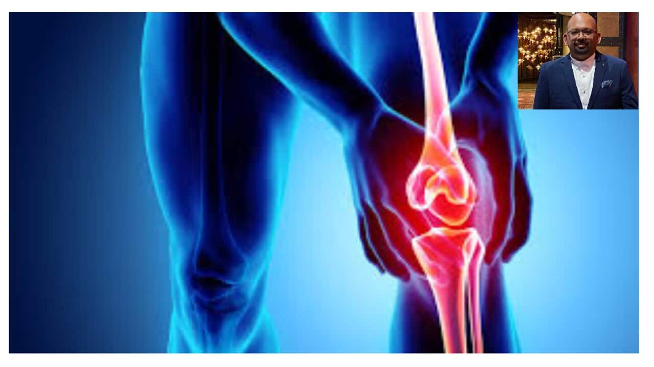 Arthritis