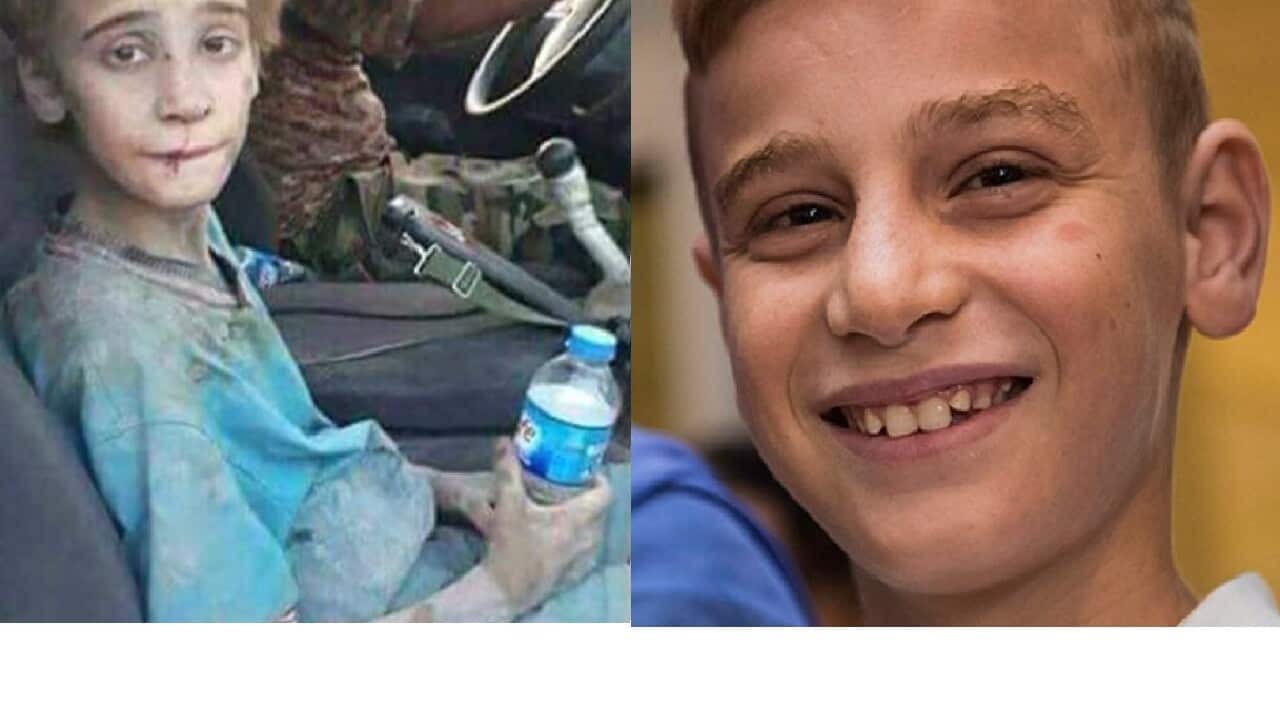 Yazidi boy Emad Tammo before and after.
