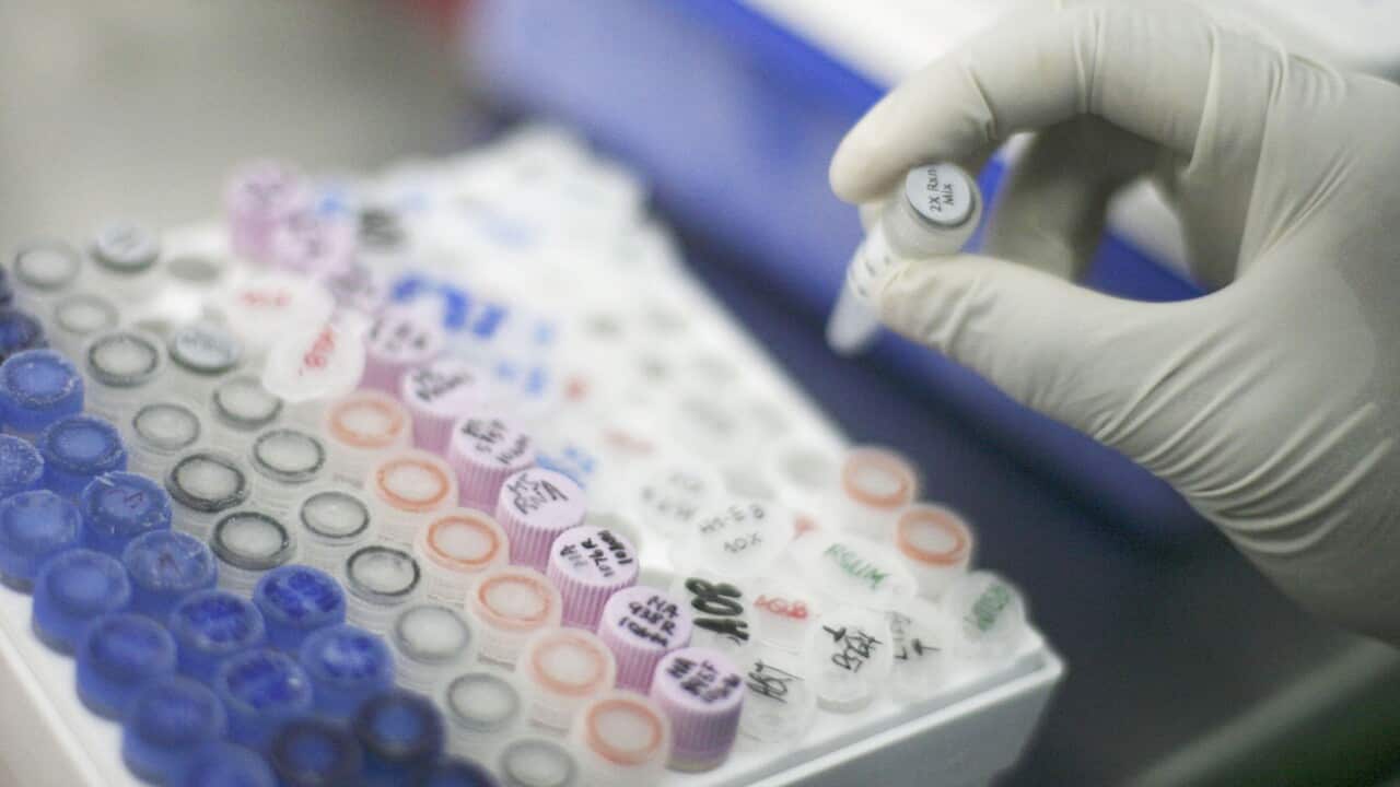 DNA_1506_get_S_117325740