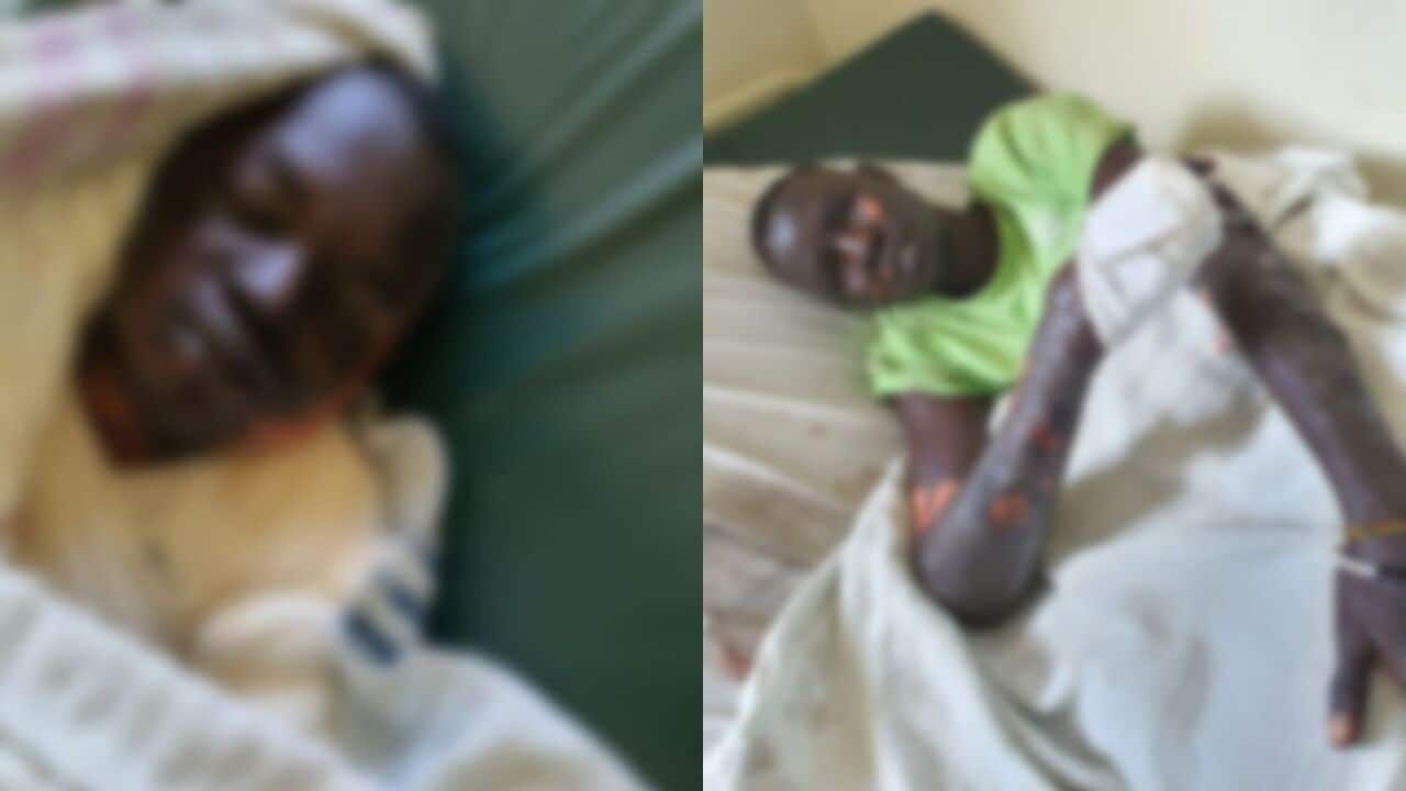 The blurry image of the two persons injured at the attack in Nakuru
