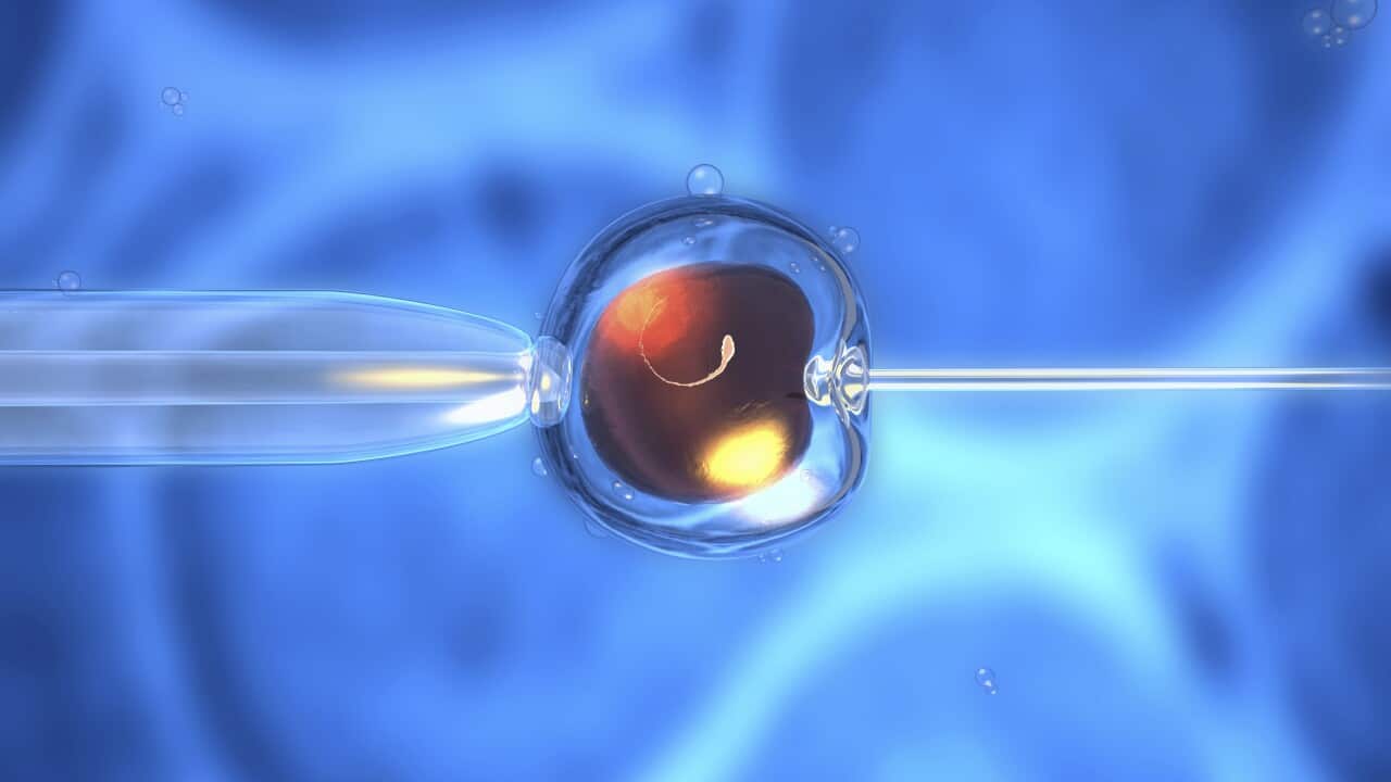 IVF, illustration