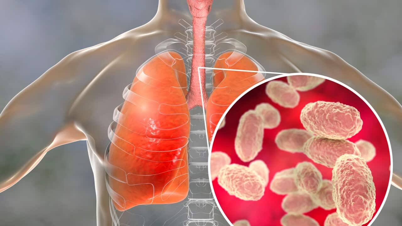 Whooping cough, conceptual illustration