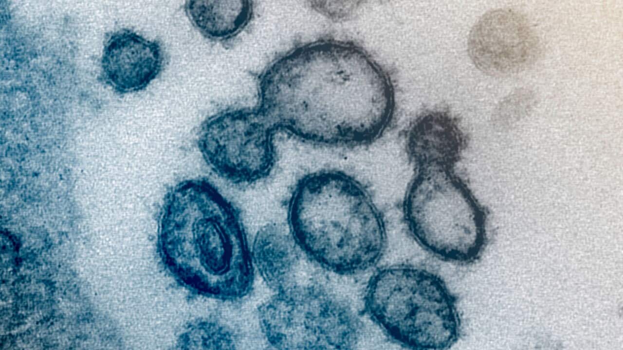 Novel Coronavirus SARS-CoV-2, which causes COVID-19